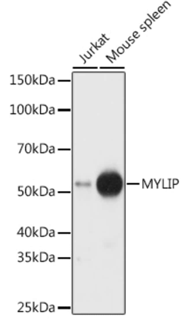 100UL MYLIP ANTIBODY 100 ul