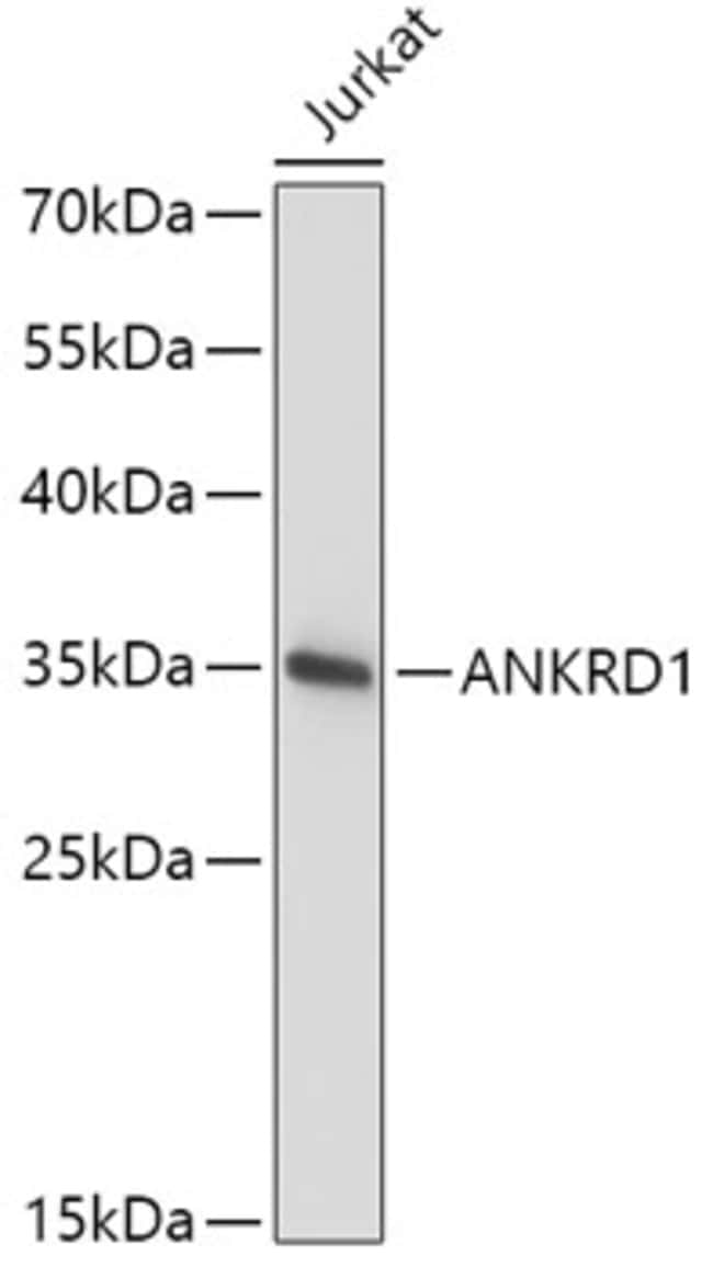 100UL CARP ANTIBODY 100 ul
