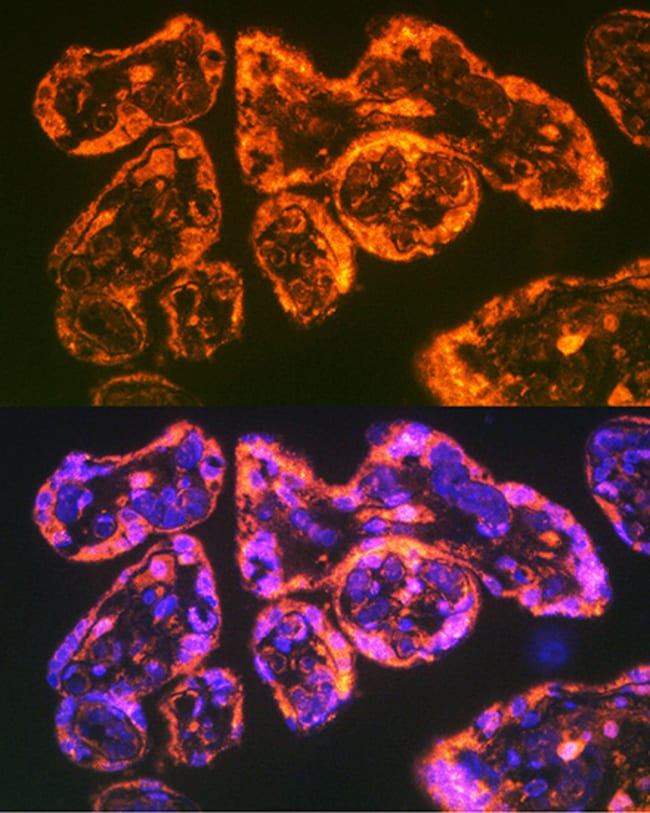 100UL CD49E (INTEGRIN ALPHA 5) ANTIB 100