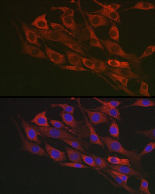 100UL FLOTILLIN 1 ANTIBODY 100 ul