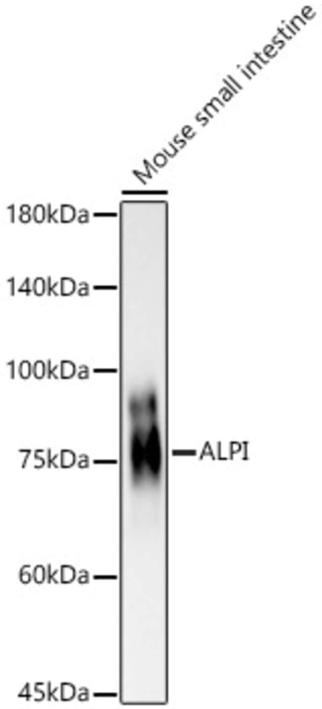100UL INTESTINAL ALKALINE PHOSPHATAS 100