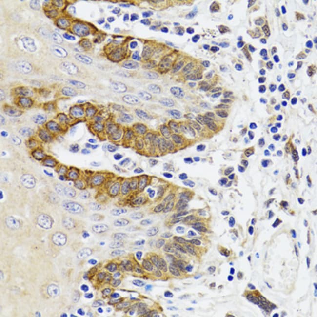 100UL ESD ANTIBODY 100 ul