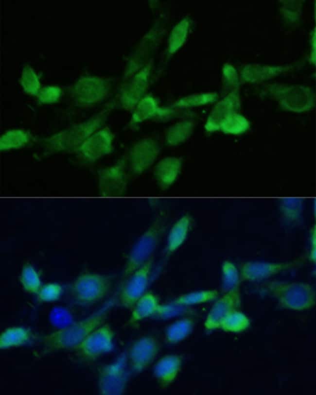 100UL FDFT1 ANTIBODY 100 ul