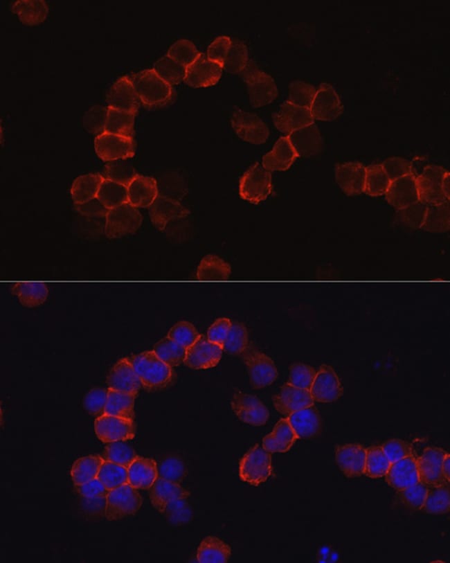 100UL CD43 ANTIBODY 100 ul