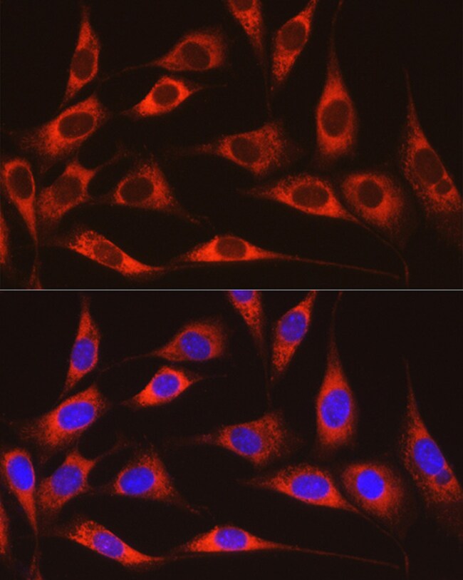 100UL ARMET ANTIBODY 100 ul