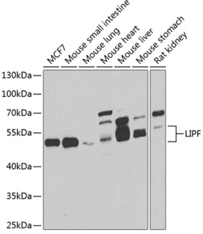 100UL LIPF ANTIBODY 100 ul