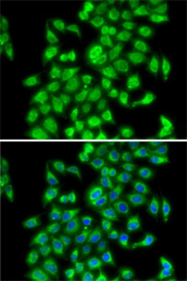 100UL COPS3 ANTIBODY 100 ul