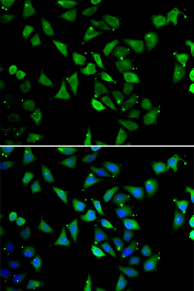 100UL EIF3C ANTIBODY 100 ul