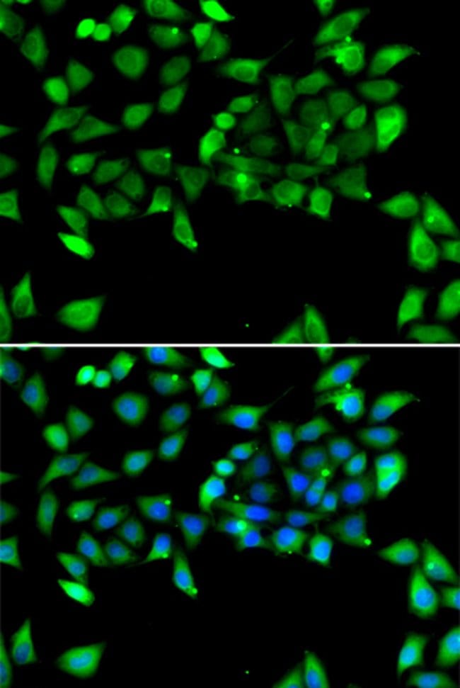 100UL EIF3H ANTIBODY 100 ul