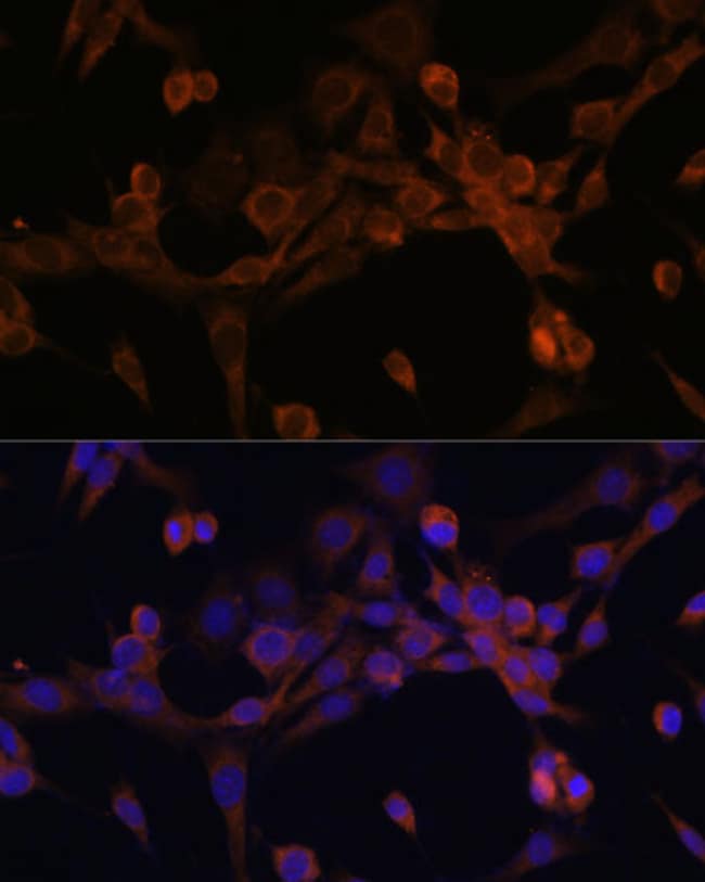 100UL EIF2B BETA ANTIBODY 100 ul
