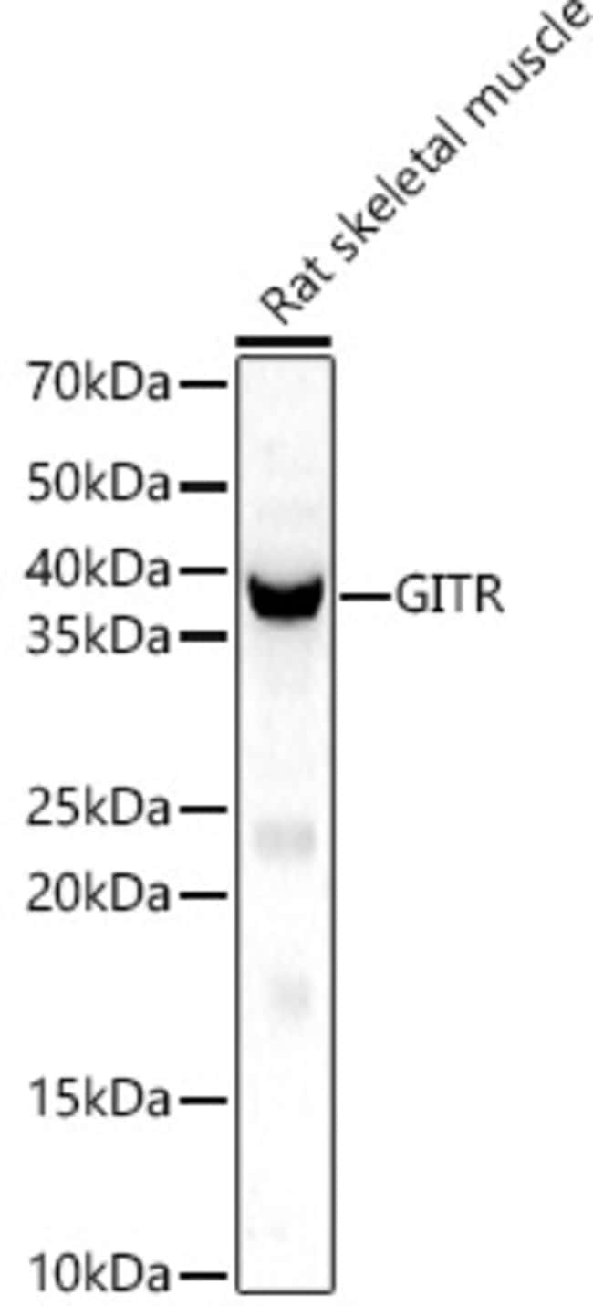 100UL GITRL ANTIBODY 100 ul