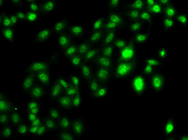 100UL MTGR1 ANTIBODY 100 ul