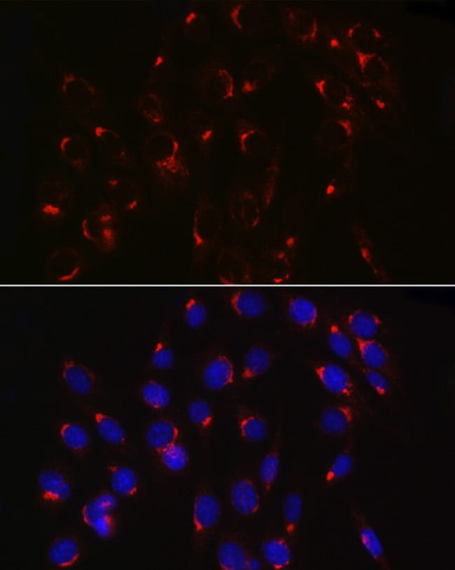 100UL COPB2 ANTIBODY 100 ul