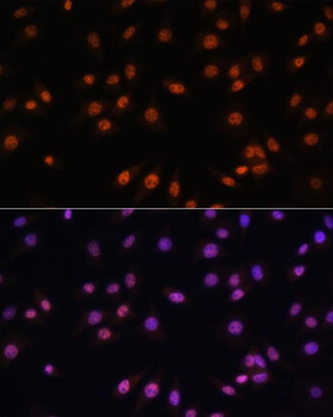 100UL EFTUD2 ANTIBODY 100 ul