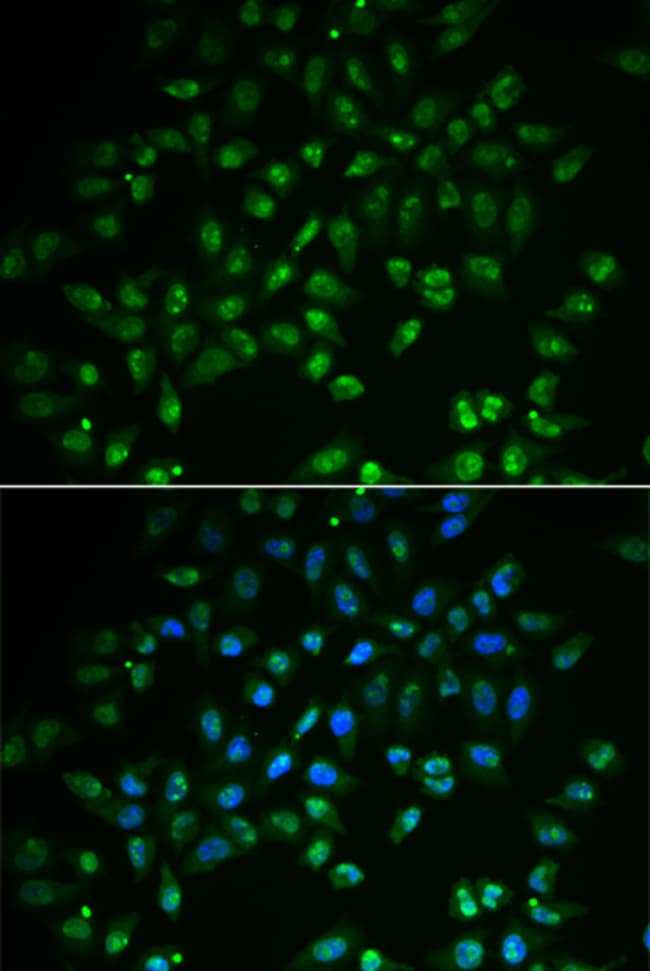 100UL HAND2 ANTIBODY 100 ul
