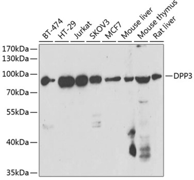 100UL DPP3 ANTIBODY 100 ul