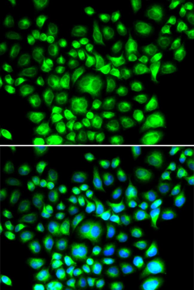 100UL BAP31 ANTIBODY 100 ul