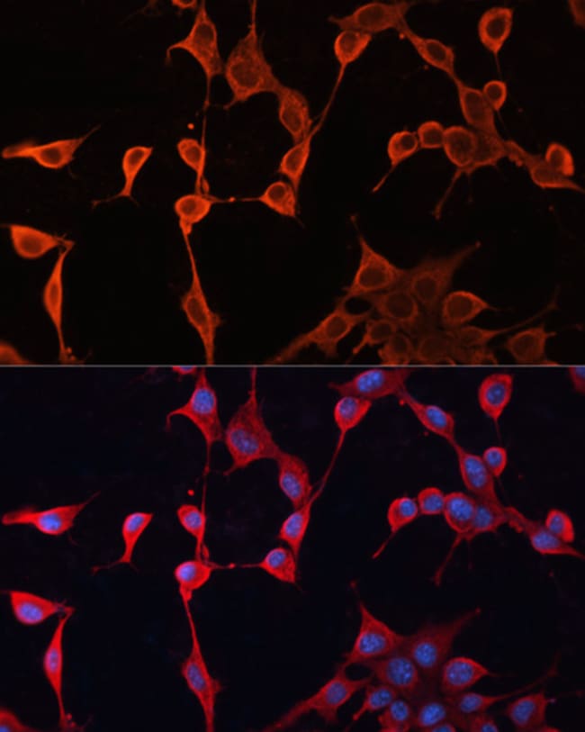 100UL DNAJA2 ANTIBODY 100 ul