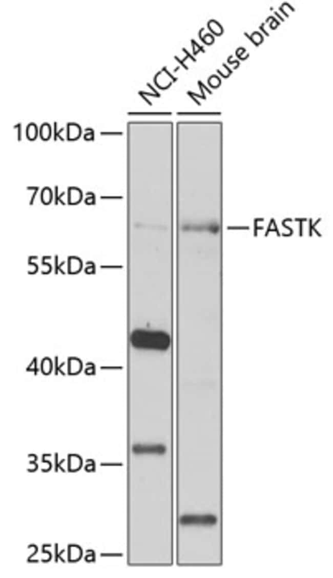 100UL FASTK ANTIBODY 100 ul