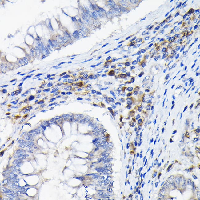 100UL CD85K (GP49B) ANTIBODY 100 ul