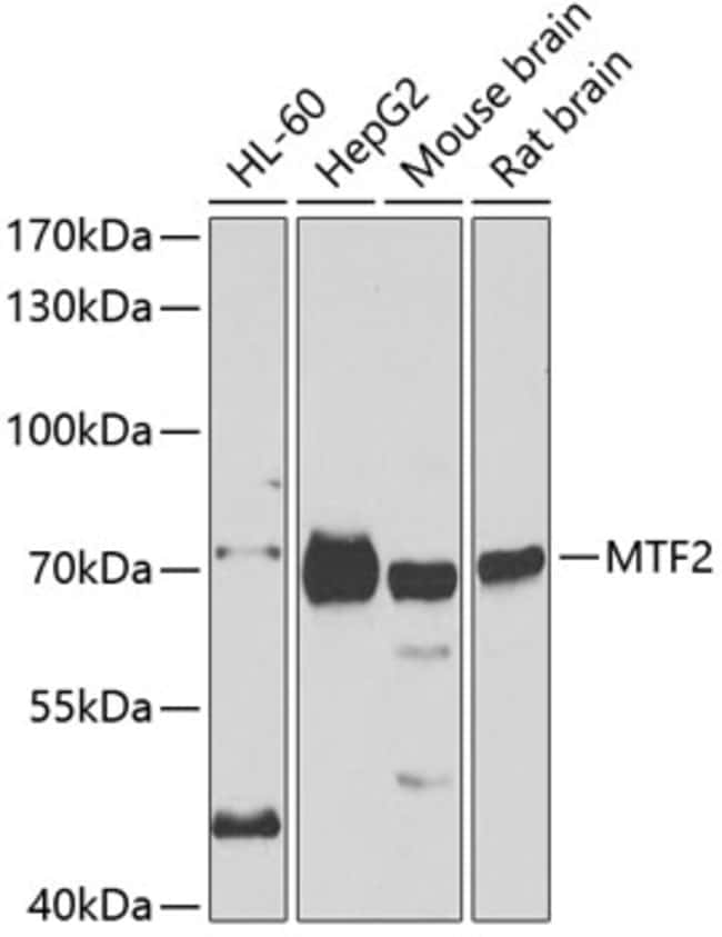 100UL MTF2 ANTIBODY 100 ul
