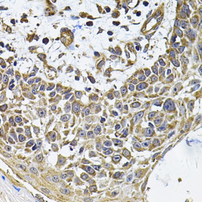 100UL CD275 (B7-H2) ANTIBODY 100 ul