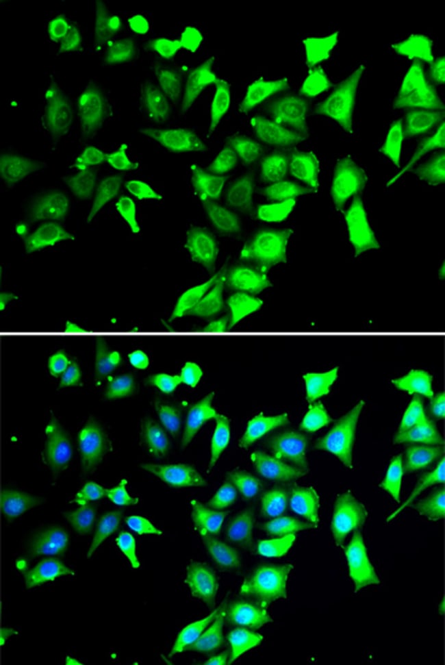 100UL FKBP8 ANTIBODY 100 ul