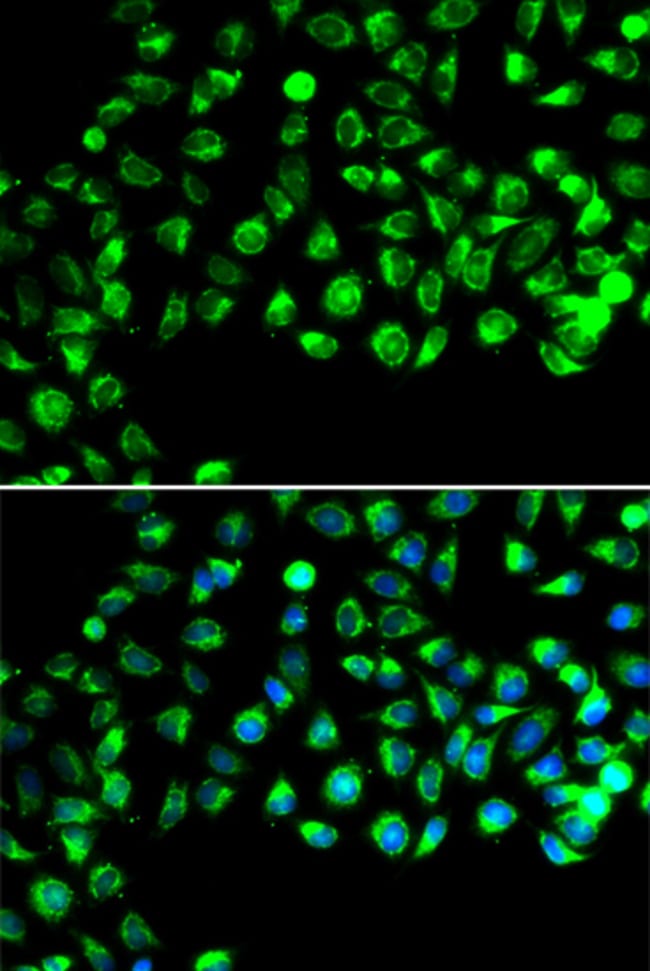 100UL C16ORF80 ANTIBODY 100 ul