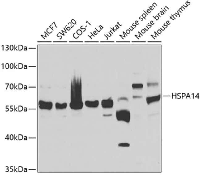 100UL HSPA14 ANTIBODY 100 ul