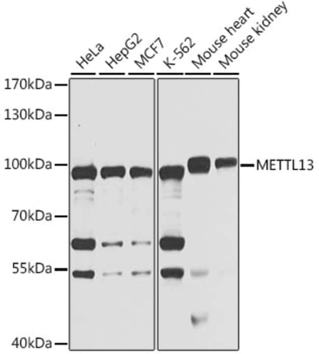 100UL METTL13 ANTIBODY 100 ul
