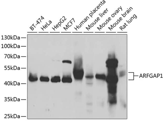 100UL ARFGAP1 ANTIBODY 100 ul