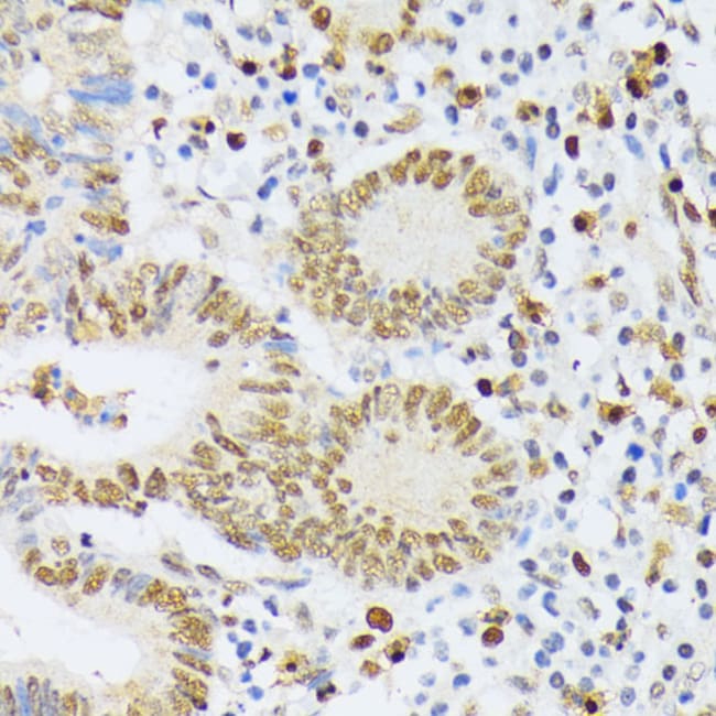 100UL ELAC2 ANTIBODY 100 ul