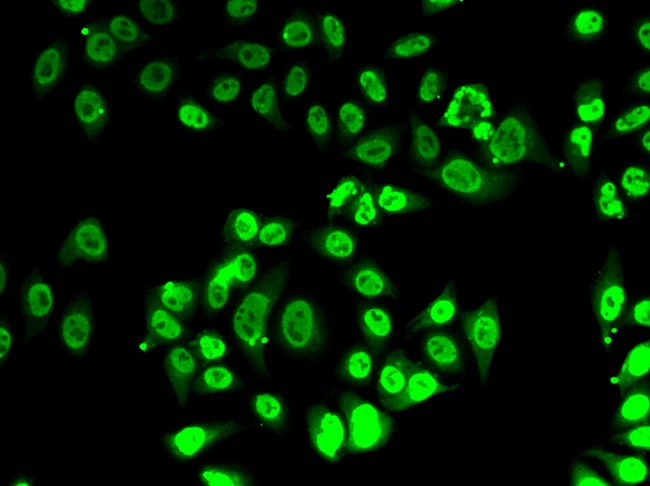 100UL FIP1L1 ANTIBODY 100 ul