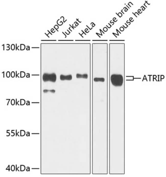 100UL ATRIP ANTIBODY 100 ul
