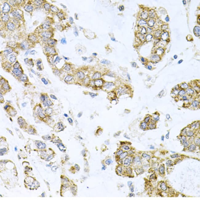 100UL ALKBH8 ANTIBODY 100 ul