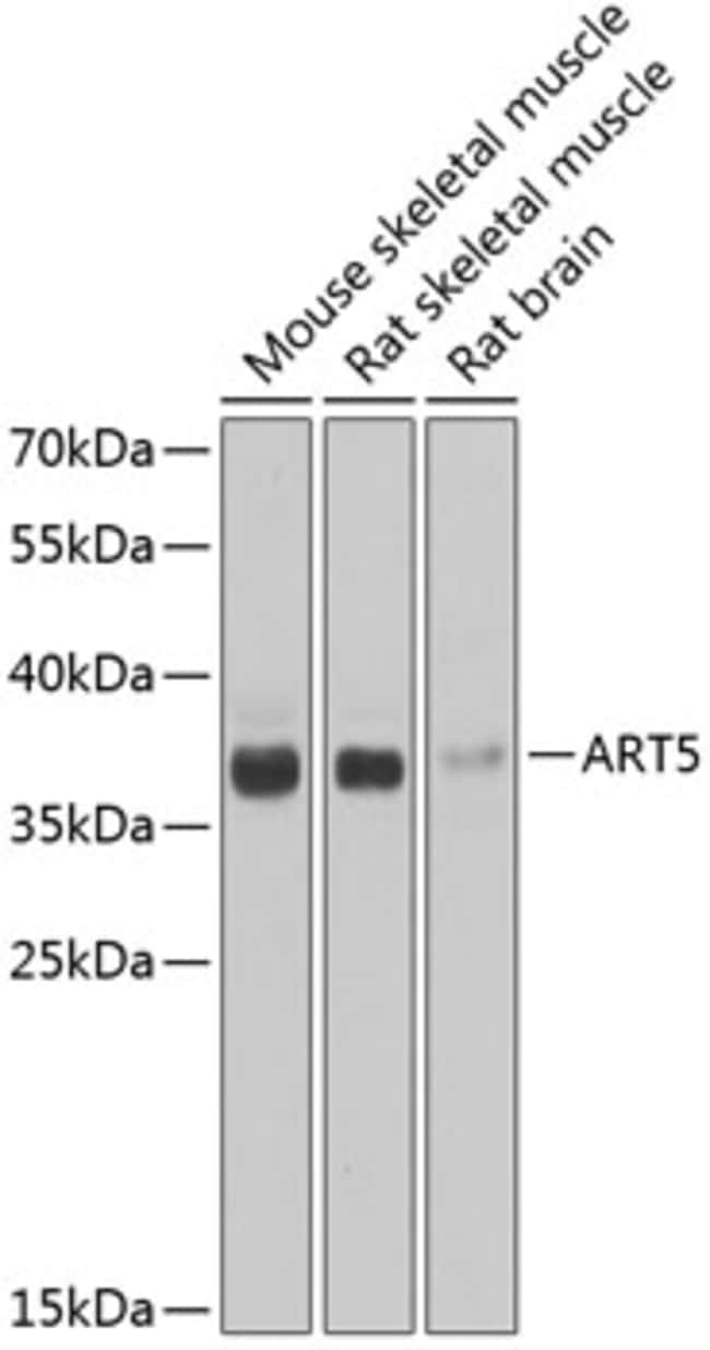 100UL ART5 ANTIBODY 100 ul
