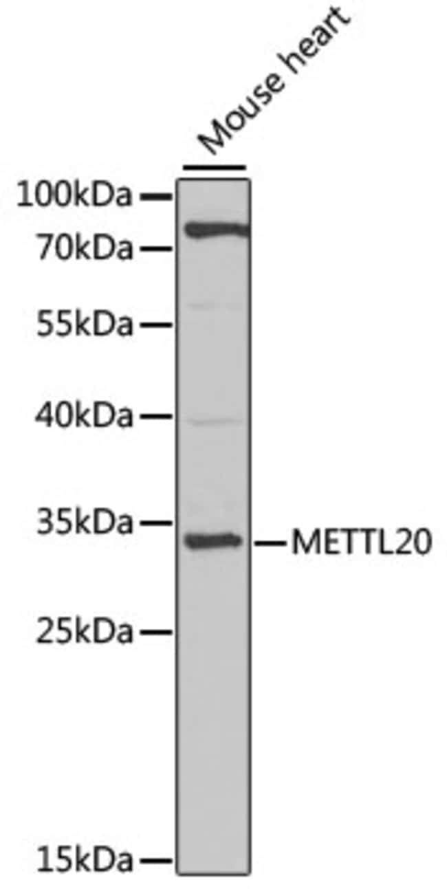 100UL METTL20 ANTIBODY 100 ul