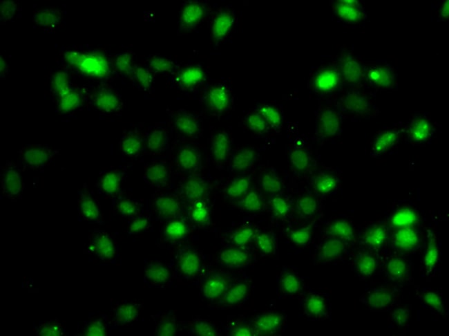 100UL BCL6 ANTIBODY 100 ul