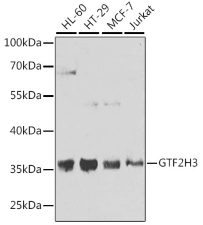 100UL GTF2H3 ANTIBODY 100 ul