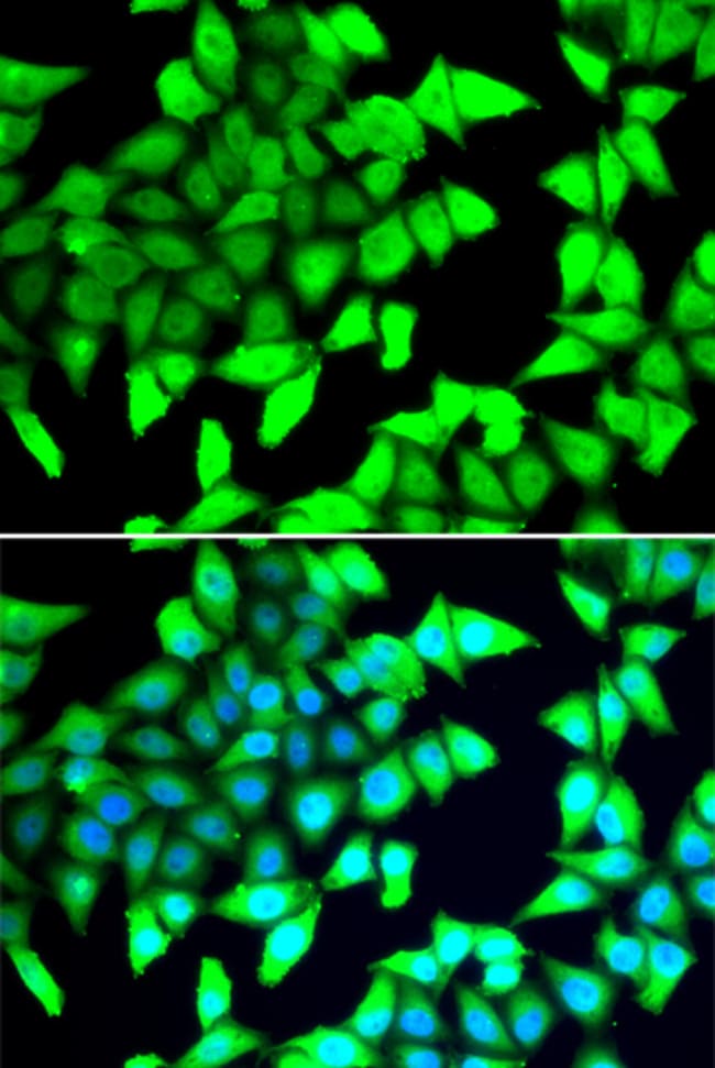100UL HDAC5 ANTIBODY 100 ul