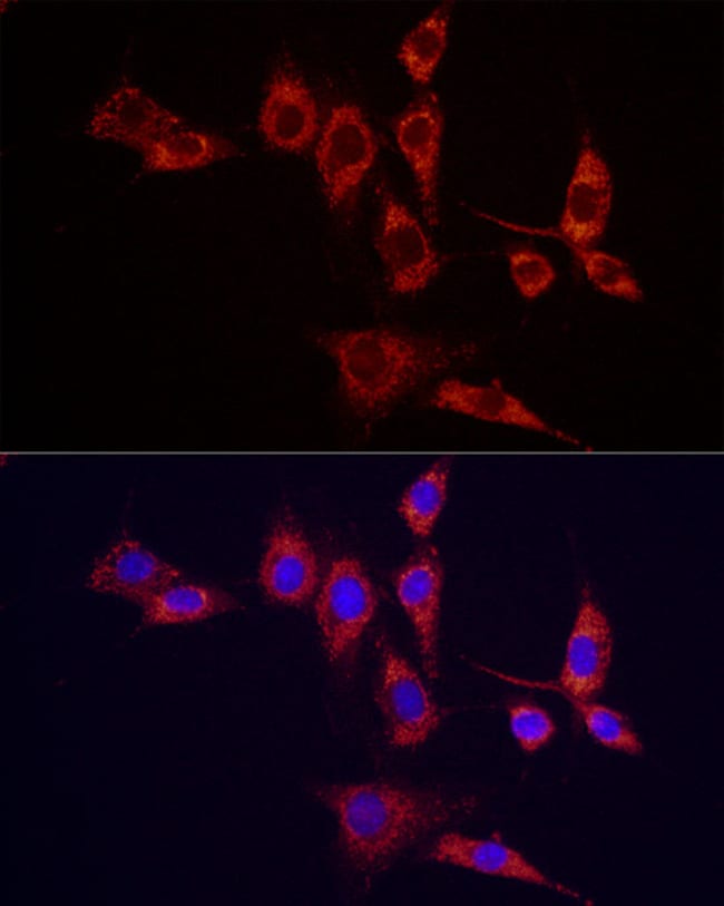 100UL IDH2 ANTIBODY 100 ul