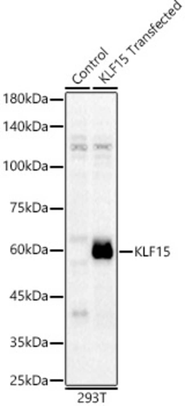 100UL KLF15 ANTIBODY 100 ul