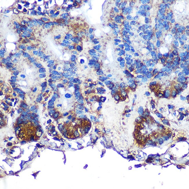 100UL ITLN1 ANTIBODY 100 ul