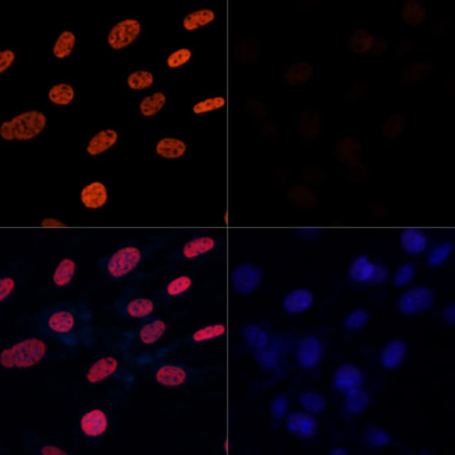 100UL ACETYL-HISTONE H3 (LYS27) ANTI 100