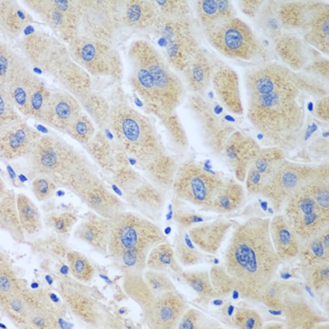 100UL FLAVIN REDUCTASE ANTIBODY 100 ul