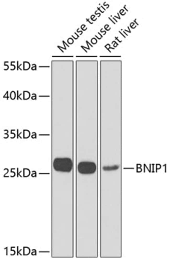 100UL BNIP1 ANTIBODY 100 ul