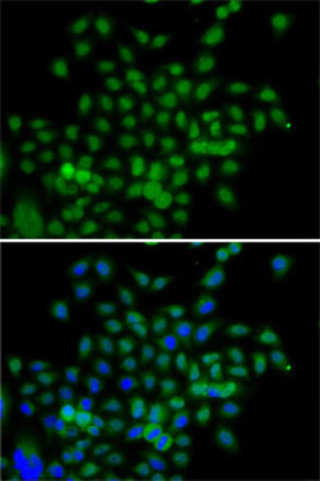 100UL BCAS3 ANTIBODY 100 ul