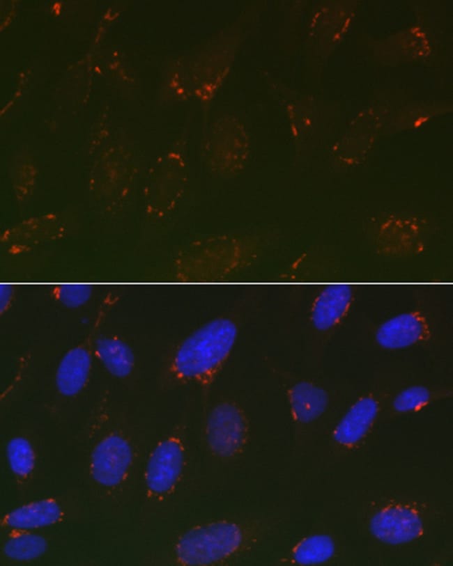 100UL GOLPH2 ANTIBODY 100 ul