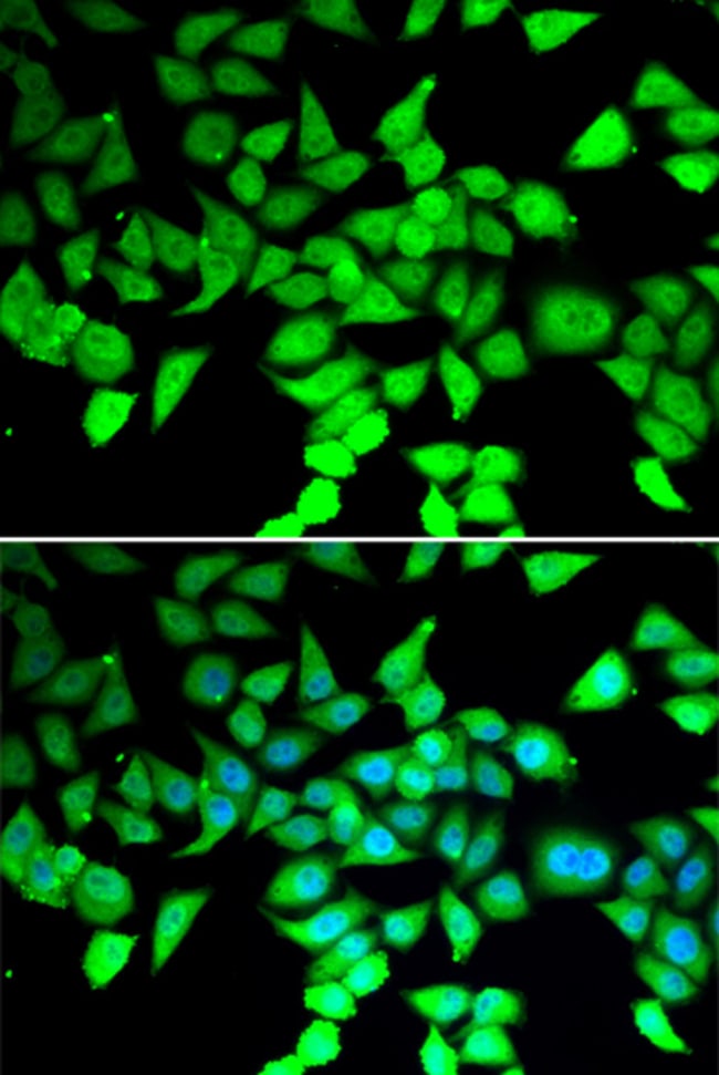 100UL HDAC7 ANTIBODY 100 ul