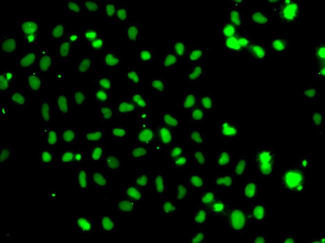 100UL HMG20A ANTIBODY 100 ul
